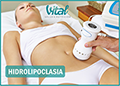 Hidrolipoclasia